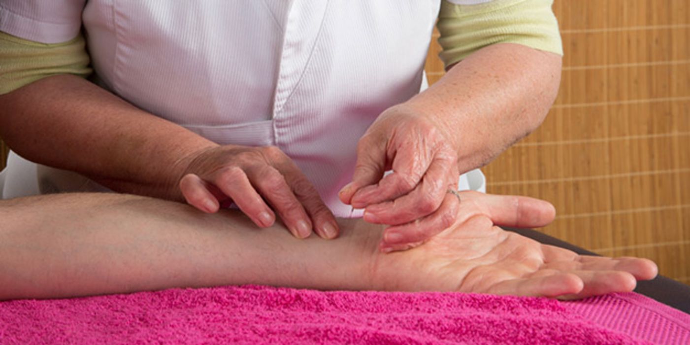 Akupunktur kann helfen, den Blutdruck zu senken.