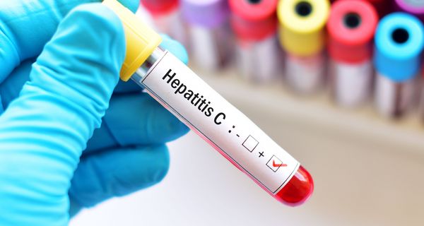 Blutprobe mit Hepatitis-C-Test.