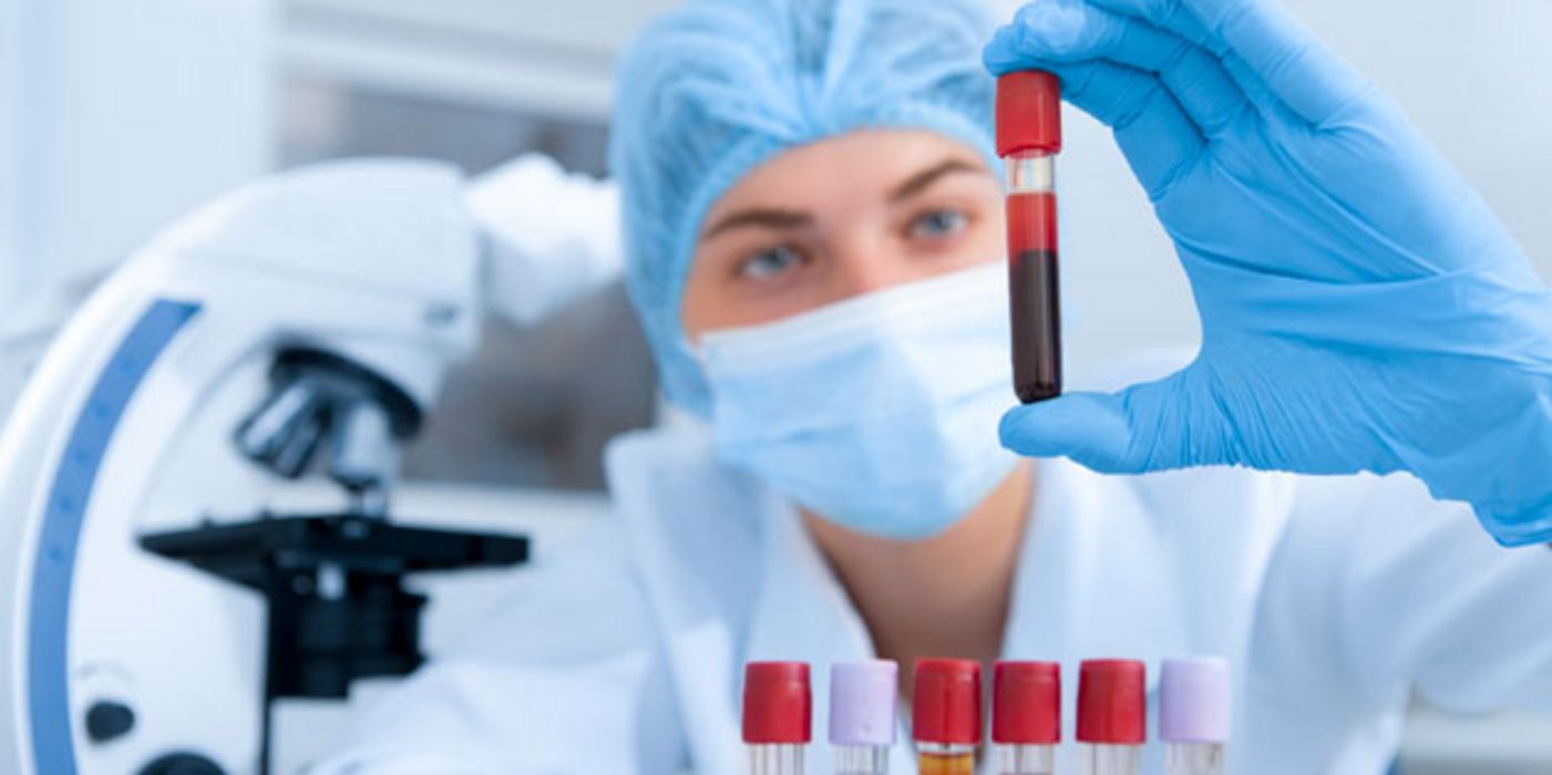 Ein neuer Bluttest ermöglicht zuverlässige Krebsfrüherkennung.