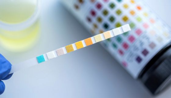 Neuer Test zeigt sofort an, ob Antibiotika nötig sind