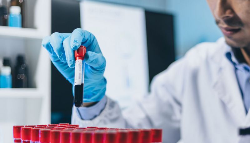 Mann im Kittel stellt ein Röhrchen mit einer Blutprobe zurück in den Ständer. 