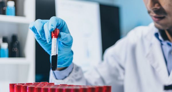 Mann im Kittel stellt ein Röhrchen mit einer Blutprobe zurück in den Ständer. 