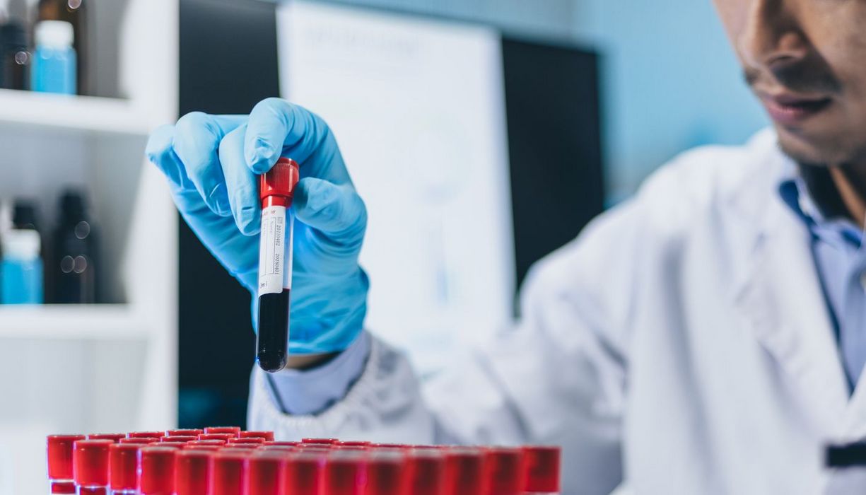 Mann im Kittel stellt ein Röhrchen mit einer Blutprobe zurück in den Ständer. 