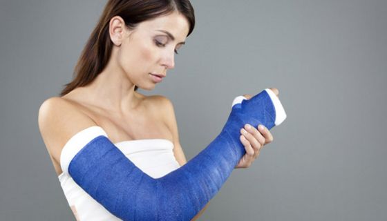 Frau mit eingegipstem Arm