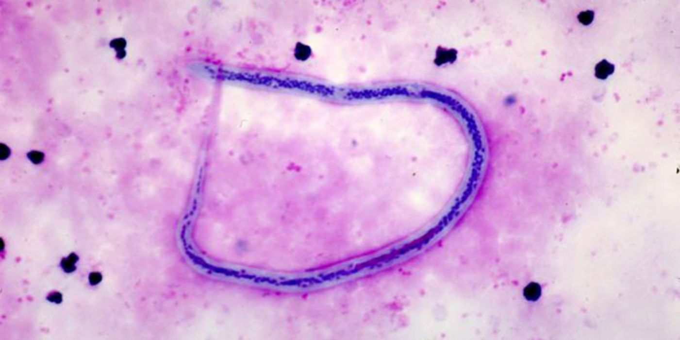 Mikroskopische Aufnahme des Fadenwurms Wuchereria bancrofti.