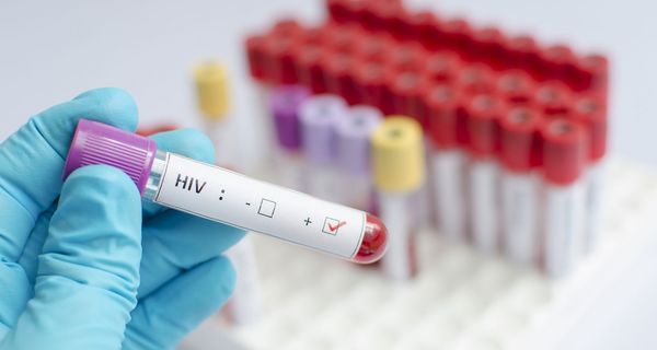 Blutröhrchen mit HIV-Test.