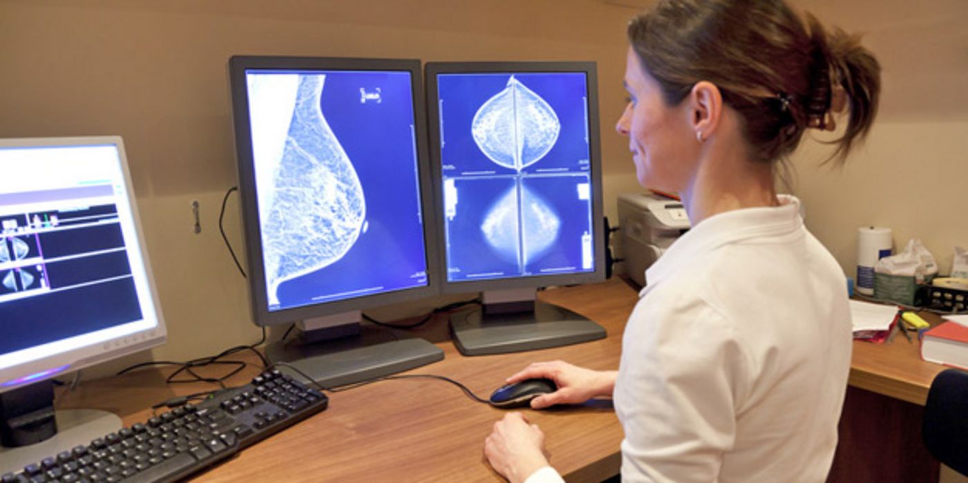 Ärztin begutachtet die Ergebnisse einer Mammmografie-Untersuchung.