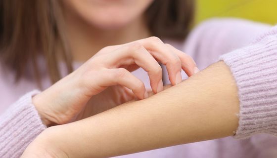 Eine junge Frau kratzt sich am Unterarm.