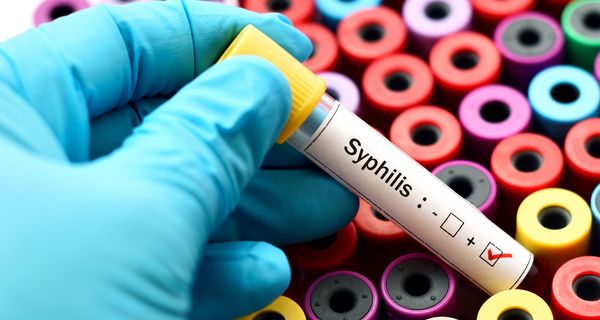 Mediziner mit einer positiven Syphilis-Probe.