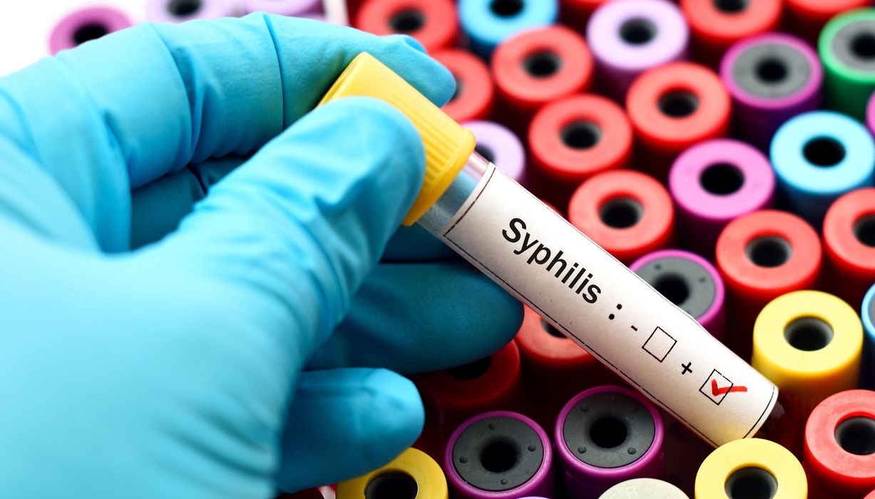 Mediziner mit einer positiven Syphilis-Probe.