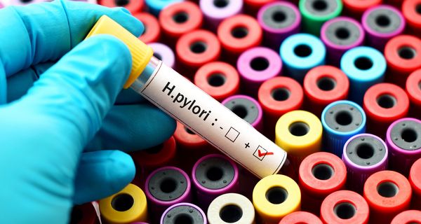 Laborröhrchen mit einer positiven H.pylori-Probe.