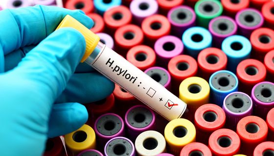 Laborröhrchen mit einer positiven H.pylori-Probe.