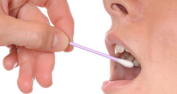 Spezielle Bakterien im Mund geben Hinweise auf Krebs.