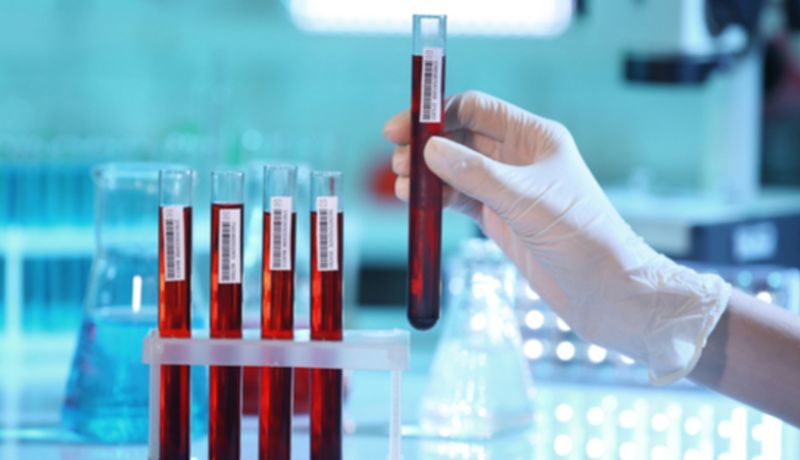 Zu Statinen gibt es bislang nur wenig Alternativen.