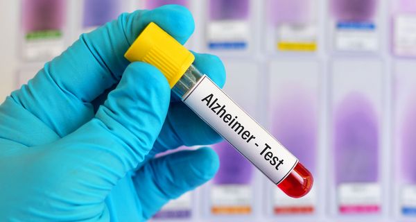 Blutröhrchen mit der Aufschrift "Alzheimer-Test". 