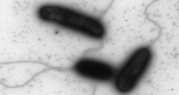 Mikroskopaufnahme Cholera-Erreger