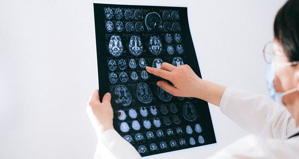 Ärztin begutachtet MRT-Scans eines Gehirns.