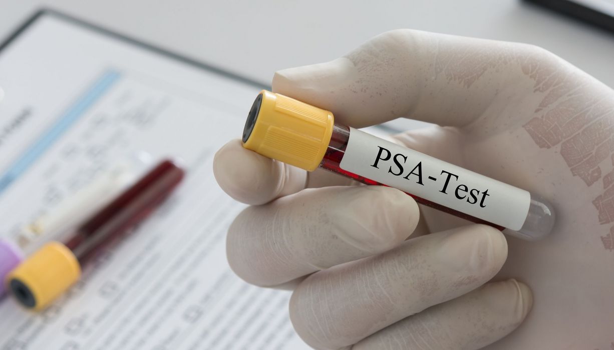 PSA-Test-Röhrchen