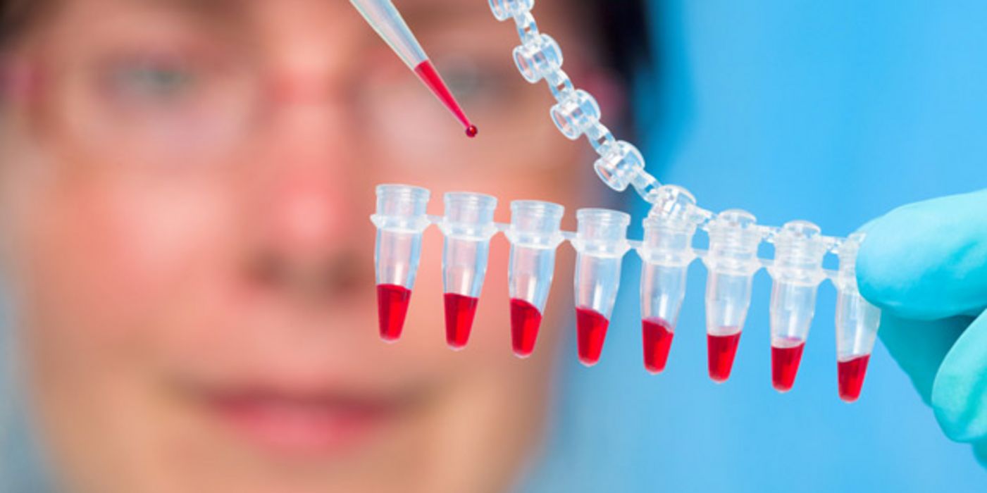Laborszene, Blutproben werden pipettiert