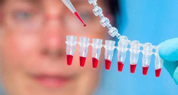 Laborszene, Blutproben werden pipettiert