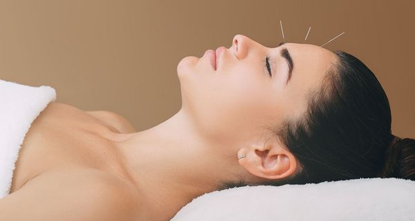 Liegende Frau mit Akupunkturnadel in der Stirn