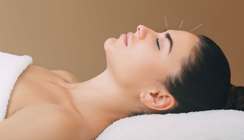 Liegende Frau mit Akupunkturnadel in der Stirn 