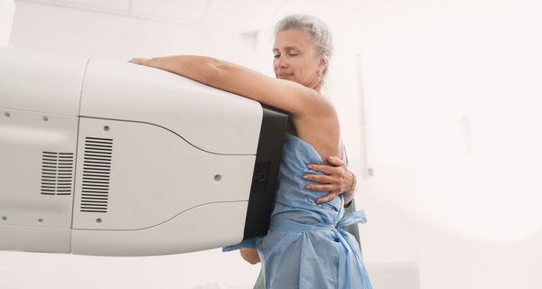 Frau bei der Mammografie.