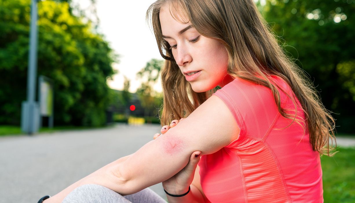 Frau schaut sich Mückenstich am Arm an.