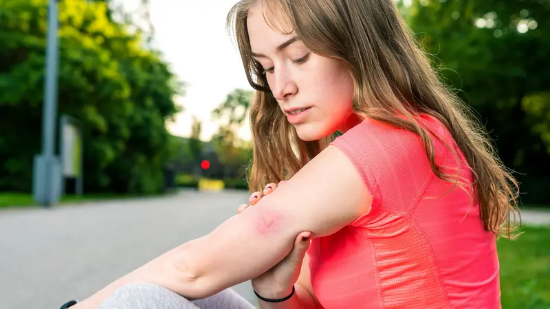 Frau schaut sich Mückenstich am Arm an.