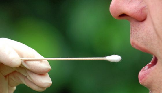 Behandschuhte Hand hält ein Wattestäbchen vor den geöffneten Mund eines Mannes