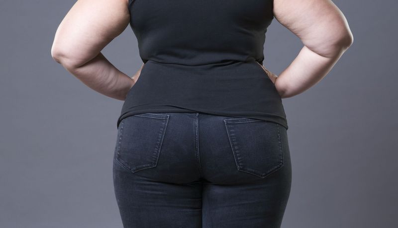 Das Gesäß einer mehrgewichtigen Frau ist von hinten zu sehen. Sie stützt ihre Arme in die Hüfte.