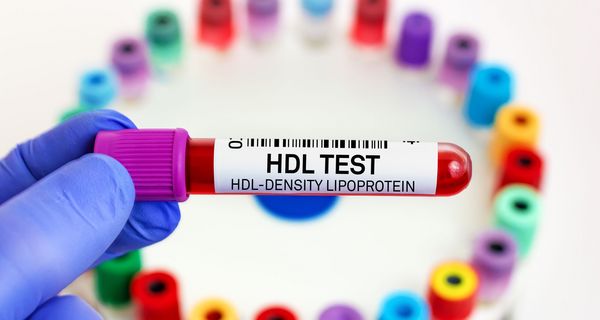 Mediziner, hält ein Blutröhrchen mit der Aufschrift "HDL Test" in der Hand.