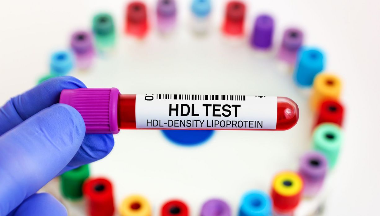 Mediziner, hält ein Blutröhrchen mit der Aufschrift "HDL Test" in der Hand.