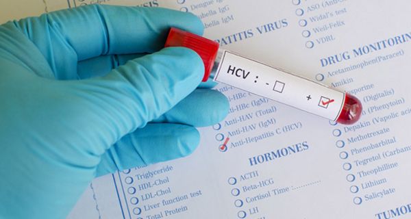 Hepatitis C wird über infiziertes Blut übertragen.