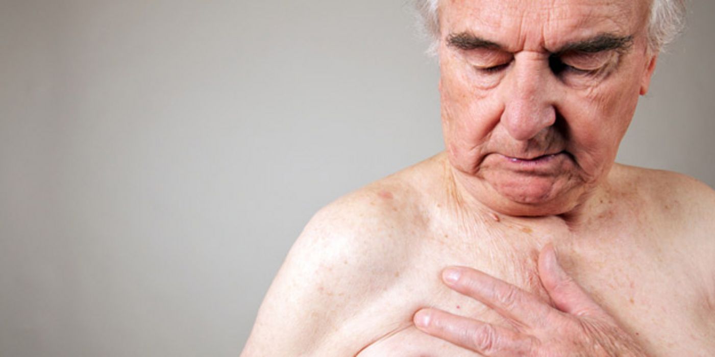 Grauhaariger, alter Mann mit nacktem Oberkörper fasst sich mit der Hand an die Brust
