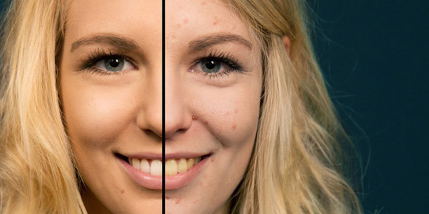 App zeigt, wie Rauchen das Gesicht verändert