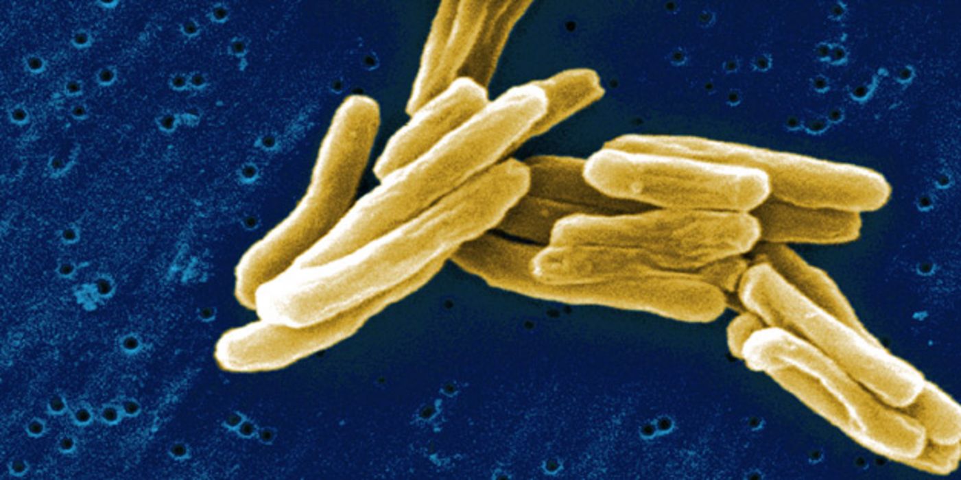 Tuberkulose-Erreger in elektronenmikroskopischer Aufnahme.
