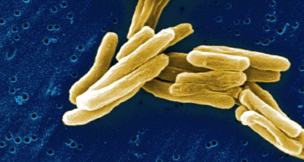 Tuberkulose-Erreger in elektronenmikroskopischer Aufnahme.