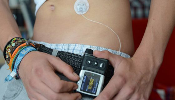 Bauch eines Jugendlichen, der am Gürtel eine Insulinpumpe trägt, die er gerade bedient