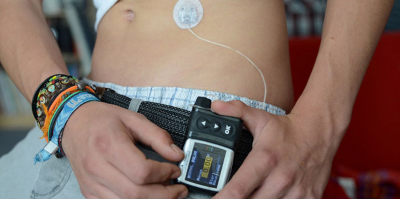 Bauch eines Jugendlichen, der am Gürtel eine Insulinpumpe trägt, die er gerade bedient