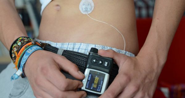 Bauch eines Jugendlichen, der am Gürtel eine Insulinpumpe trägt, die er gerade bedient