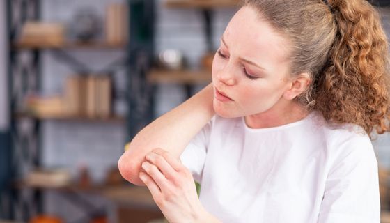 Eine Frau kratzt sich am geröteten Ellbogen.
