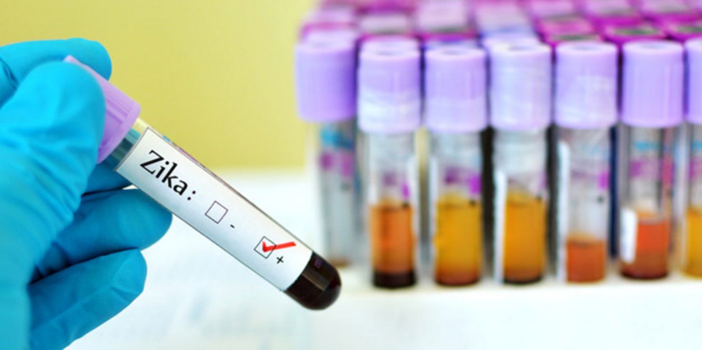 Die WHO hat wegen des Zika-Virus den globalen Notstand ausgerufen.